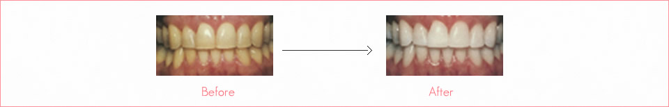 加齢によるもの