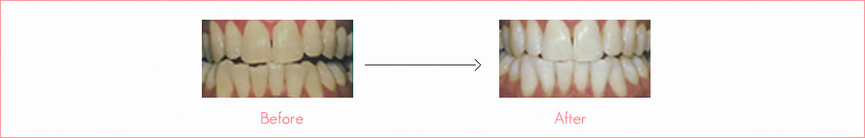 遺伝によるもの